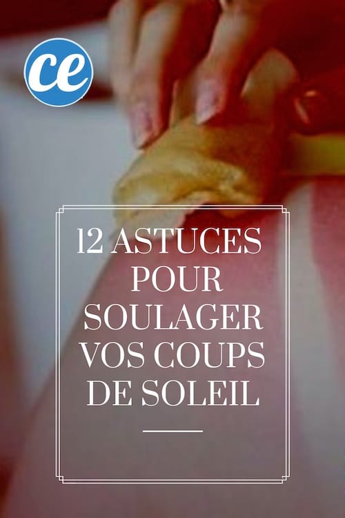 Astuces Surprenantes Pour Soulager Vos Coups De Soleil