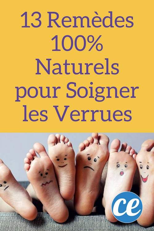 13 remèdes naturels contre les verrues