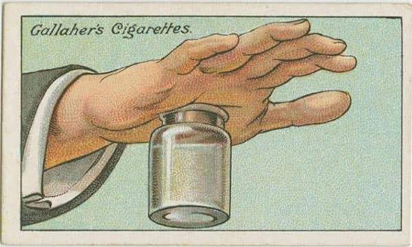 Voici une méthode ancienne pour retirer une écharde de la main.