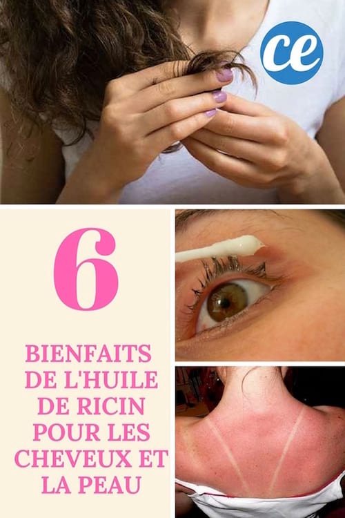 Huile De Ricin 6 Bienfaits Incroyables Pour Les Cheveux Et La Peau 