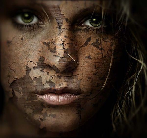 remède pour soulager peau sèche