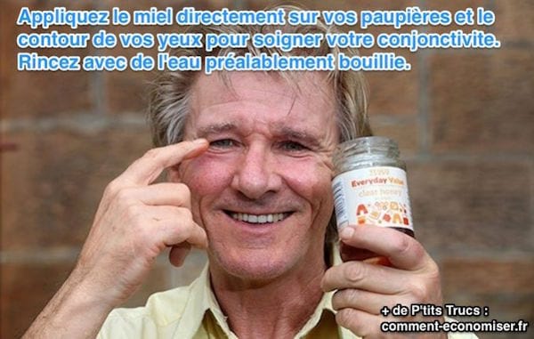Homme de grand-âge souriant : L'Ingrédient Miracle Pour Calmer une Conjonctivite Efficacement.