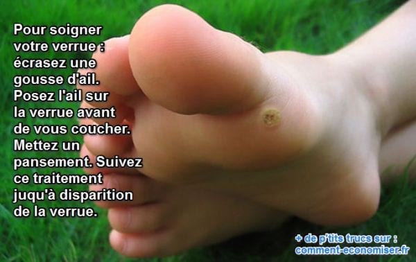 l'ail soigne les verrues