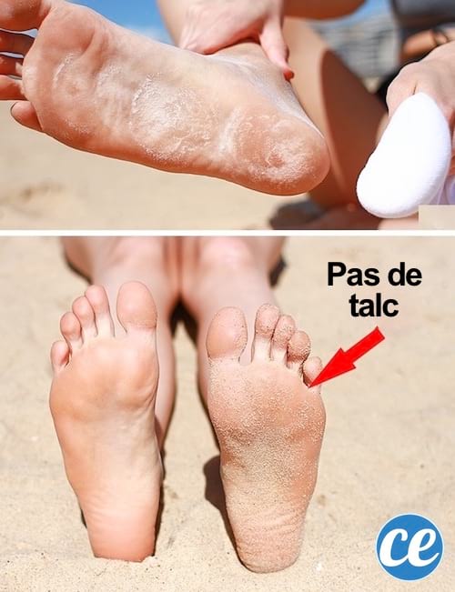 Mettre du talc sur les pieds pour éviter d'avoir du sable collé