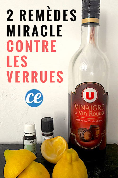 2 Remèdes Miracle Pour Venir à Bout D'une Verrue.