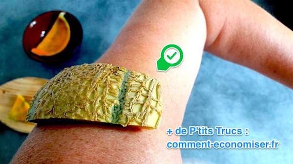 la peau du melon soulage les coups de soleil