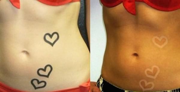 comment faire un tatouage solaire