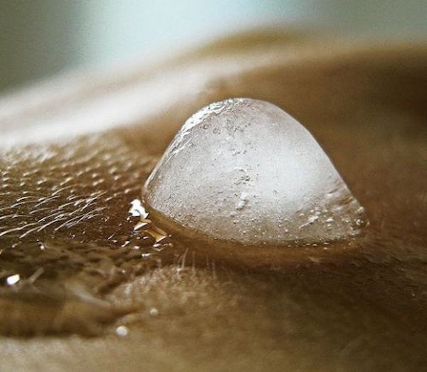 Glaçon de vinaigre blanc sur la peau pour calmer un coup de soleil