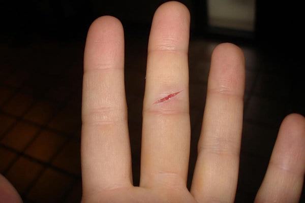 l'huile essentielle de lavande soigne les petites coupures