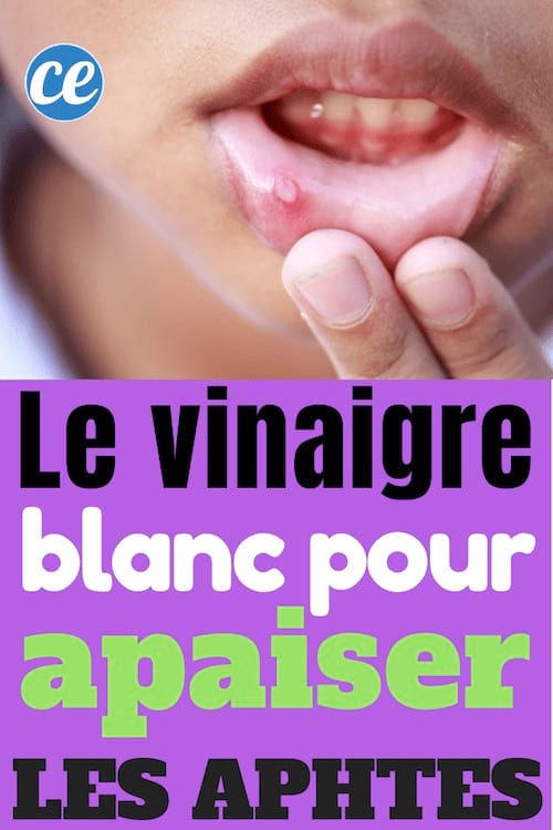 Le Vinaigre Blanc pour Apaiser et se Débarrasser des Aphtes.
