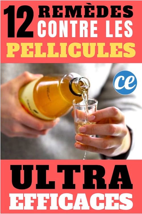 Voici les meilleurs traitements naturels pour lutter contre les pellicules.