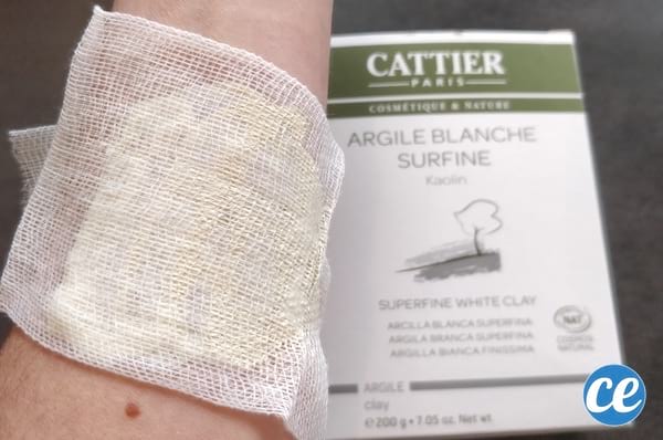 argile blanche application sur maladie de peau eczéma