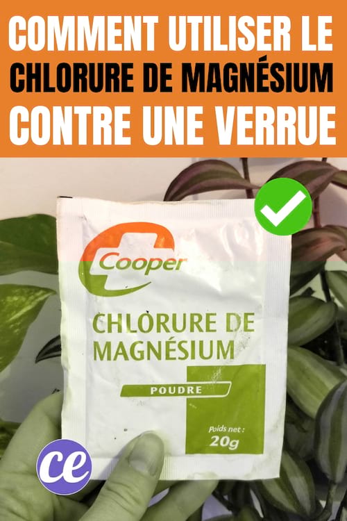 VERRUES : 2 remèdes naturels et efficaces pour les soigner rapidement