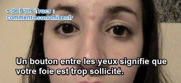 bouton acné entre les yeux signifie que votre foie est fatigué