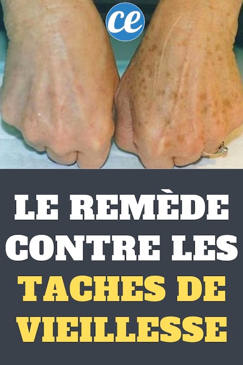 Contre les taches de vieillesse, buvez du chlorure de magnésium comme remède
