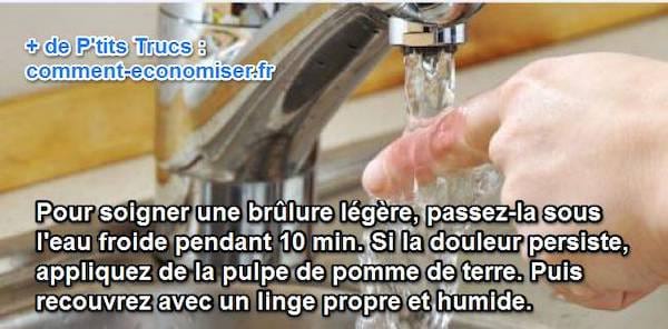 comment soulager et soigner une brulure légère et superficielle rapidement
