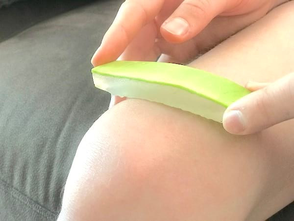 soigner une plaie avec de l'aloe vera