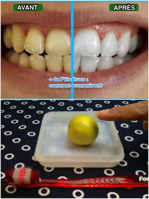 Du citron pour se brosser les dents et les blanchir