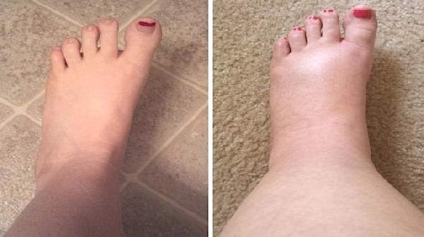 Pieds Qui Puent Remède De Grand-mère Top 10 des Meilleures Astuces De La Semaine (24 Août 2019).
