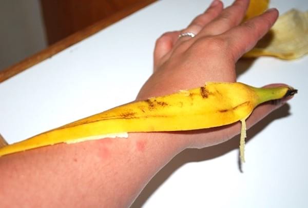 soulager piqûres insectes avec peau banane