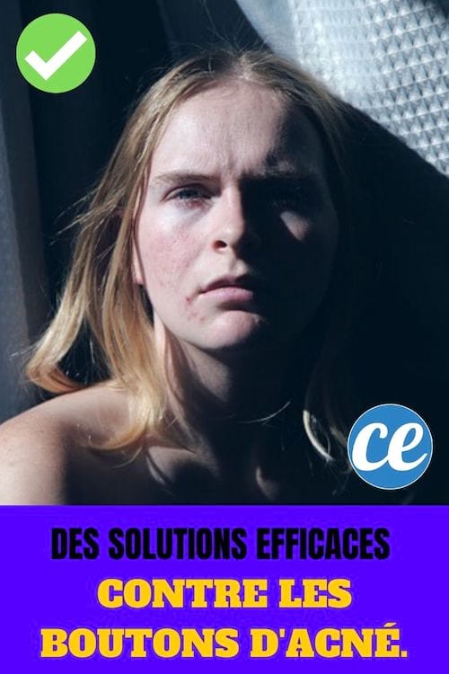 Femme avec de l'acné