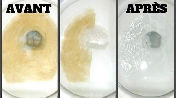 7 Astuces Simples Et Efficaces Contre Le Tartre Dans Les WC