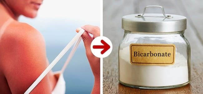 Une femme avec des coups de soleil à gauche et du bicarbonate à droite pour se soigner