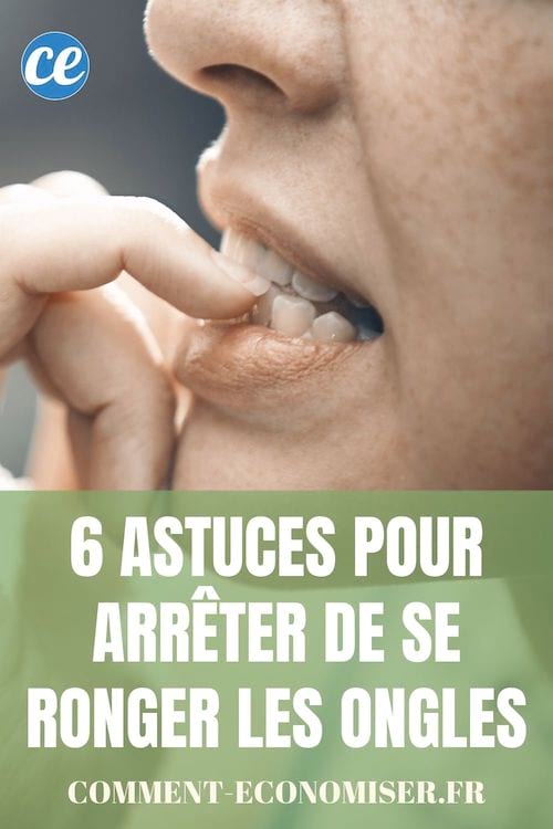 6 astuces pour arrêter de se ronger les dents.