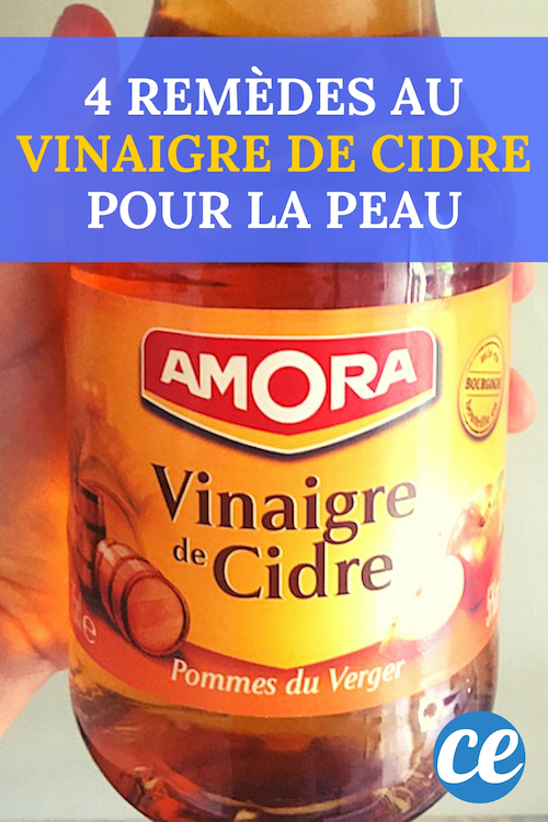Acné, Eczéma, Bouton de Fièvre... 4 Super Remèdes au Vinaigre De Cidre.