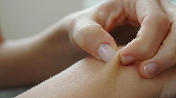 Une personne se pince la peau