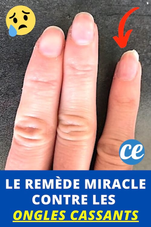 Ongles Cassants ? Le Remède Miracle Pour Des Ongles INCASSABLES ! 