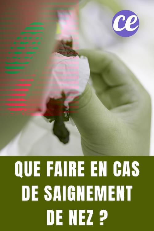 Saignement de nez : Que faire en cas de saignement de nez ?