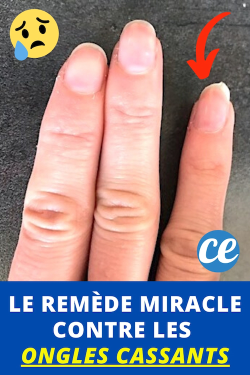 Ongles Cassants ? Le Remède Miracle Pour Des Ongles Incassables.