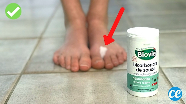 Mycose de Pieds : 4 Traitements au Bicarbonate de Soude.