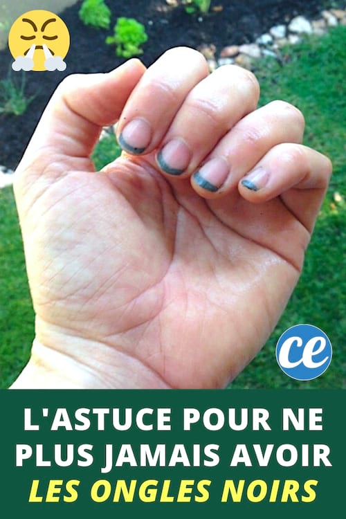 Une mains avec des ongles noirs après avoir fait le jardinage