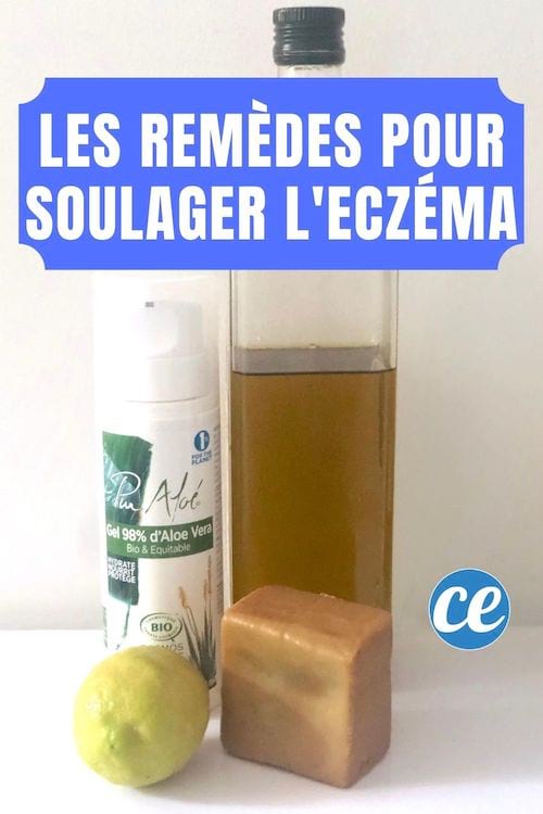de l'huile d'olive et du citron, du gel d'aloe vera et du savon d'Alep pour soulager les démangeaisons dues à l'eczéma
