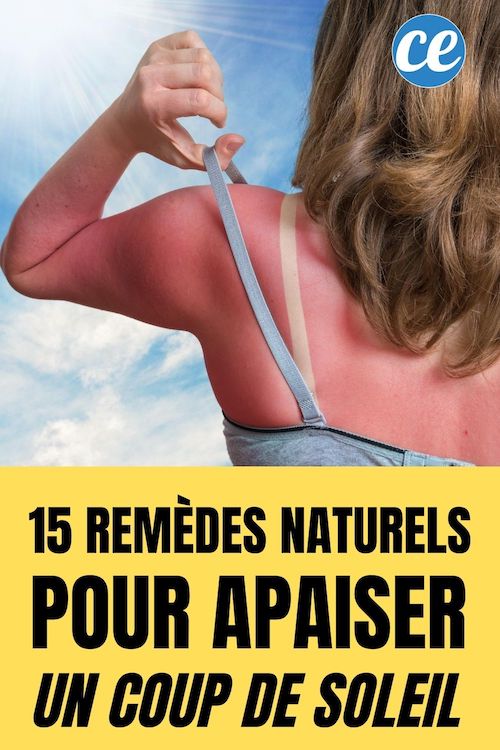 Le Coup De Soleil 15 Remèdes Naturels Pour Soulager un Coup de Soleil SANS Biafine.