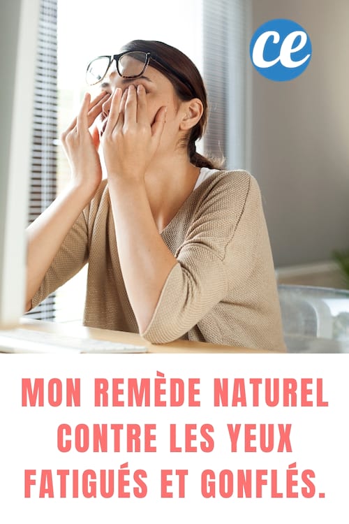Femme fatiguée : Mon Remède Naturel Contre les Yeux Fatigués et Gonflés.