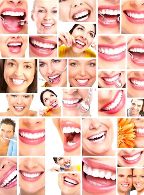 Un montage photo de sourires avec des dents blanches et saines.