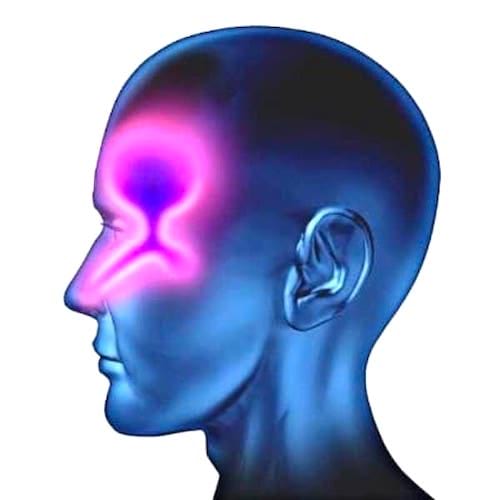 Une représentation en couleur d'une tête avec une infection des sinus.