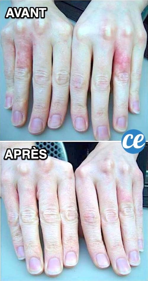 Des mains abim&eacute;es et s&egrave;ches avant et apr&egrave;s toutes douces gr&acirc;ce au beurre de karit&eacute;