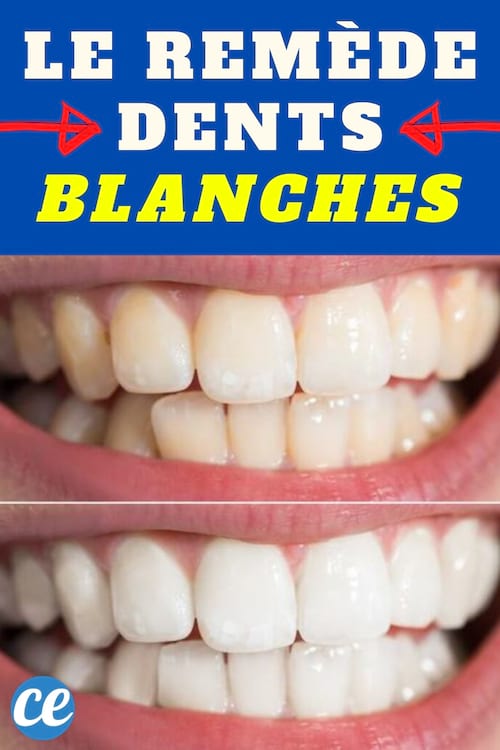 Le Remède de Grand-Mère Méconnu Pour les Blanchir Rapidement.