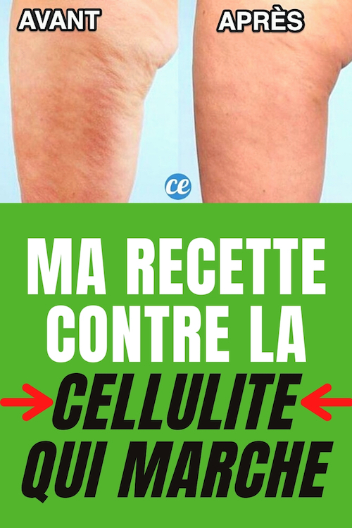 Ma Recette de Grand-M\u00e8re Contre la Cellulite Qui Marche Vraiment.