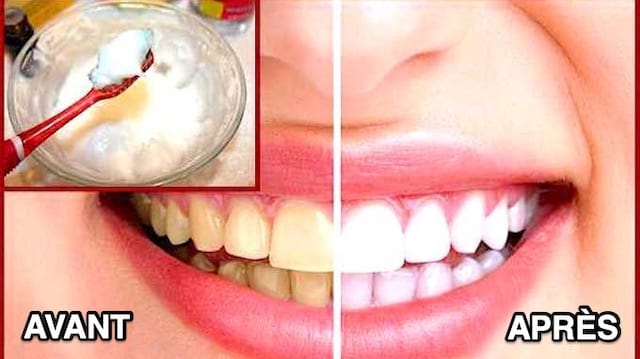 Utilisez du bicarbonate et de l'eau oxygénée pour faire une pâte qui blanchit les dents