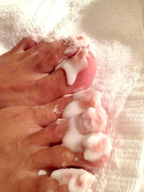 Du bicarbonate de soude sur des ongles de pieds pour les blanchir