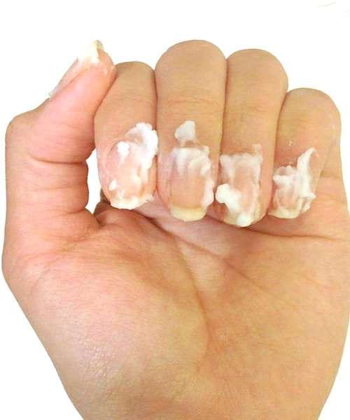 Du bicarbonate de soude en pâte sur des ongles de la mains