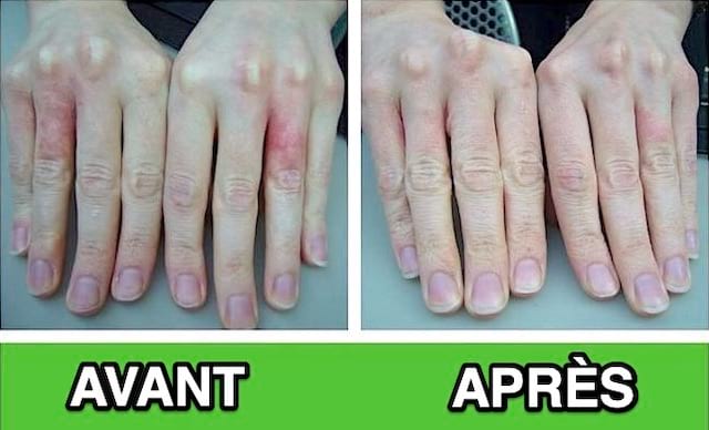 Des mains abîmées par les lavages avant et après toutes douces