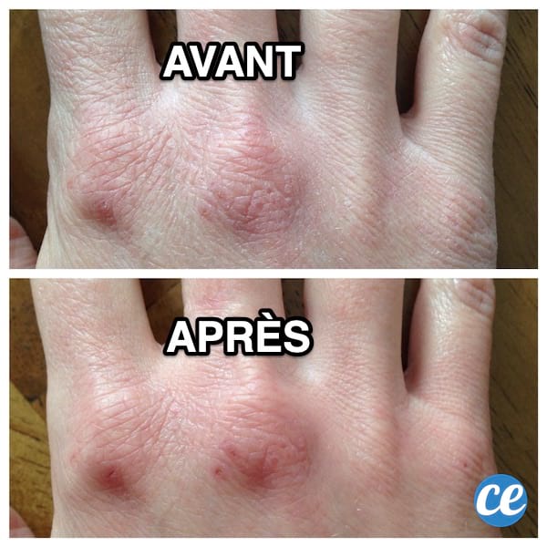 Des mains sèches à cause des lavages fréquents et des mains douces grâce à l'huile de jojoba