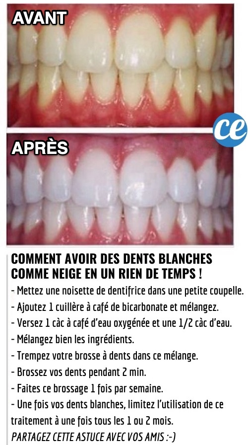 Blanchir ses Dents avec du Bicarbonate et l'Eau Oxygénée. — free download