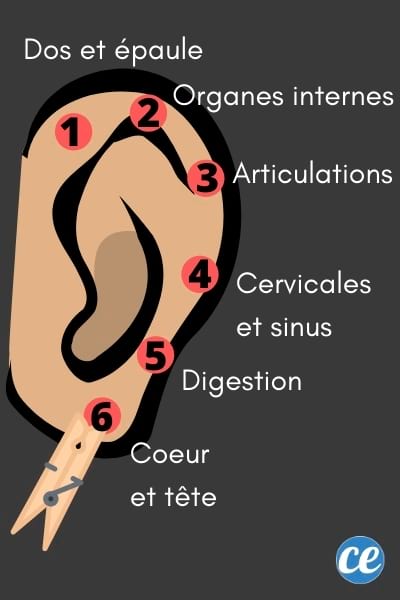 points acupressions oreille